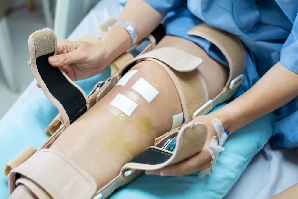 Total Knee Replacement